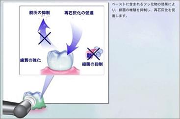 再石灰化の促進